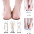 RunY 1 Pair Silicone Insole Correct Leg Shape O/X Legs Heel Pad Elastic Soft Cushioning. 