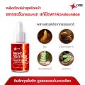 LYSE คู่หูหน้าเด้งคูณ 2 เซรั่มยกกระชับผิวหน้า + ครีมฟิลเลอร์ (30 กรัม) ของแท้ 100% ส่งฟรี!!!. 