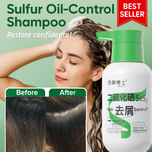 Selenium Sulfide Anti-Dandruff Shampoo Oily Scalp Controls Flakes Itch Nourishing Hair Volumizing Smoothing Selenium Sulfide Shampoo Anti-Dandruff Treatment Scalp Wash