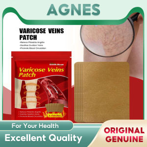 South Moon Varicose Veins Treatment Blood Vessel Swelling Spider Leg Vasculitis Phlebitis Care Angiitis Plaster Patch For Women Men Patch Vascular Veins Remover Spider Legs Treatment Chinese Medical Plaster Angiitis Stickers Skin Care(6pcs)