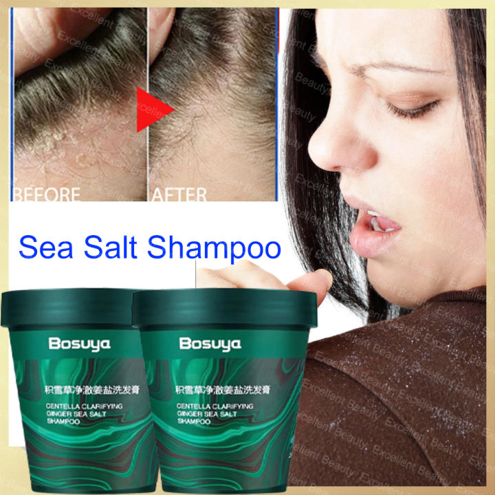 Sea Salt Anti Dandruff Shampoo For Dandruff and Scalp Treatment Fast