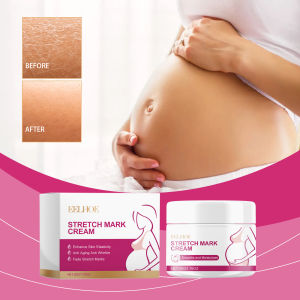 EELHOE Stretch Mark Cream Stretch Mark Scar Removal Massage Cream Stretch Mark Mark Care Cream Skin Repair Massage Cream Moisturizes And Nourishes the body (50g)