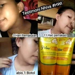 BBM-1 Pcs PRIME SKIN LOTION (Kaki pecah-pecah Kulit kering )