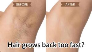 Dầu tinh khiết 100% từ cây Cyperus Rotundus dùng để tẩy lông và dưỡng da sau khi tẩy lông.    Sản phẩm ức chế mọc tóc tự nhiên giúp giảm đáng kể tình trạng tóc mọc lại dùng để chăm sóc da sau khi cạo râu và sau khi tẩy lông phù hợp cho cả mặt và cơ t