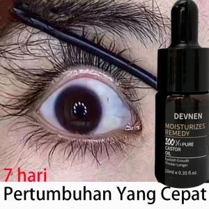 Serum Bulu Mata/Serum Bulumata Penumbuh Bulu Mata/Eyelash Serum Pemanjang/Oil Lash Serum Alis Dan Bulu Mata Instant Dalam/Perawatan Pertumbuhan Bulu Mata Herbal Serum Cair Enhancer Kuat Lash Mata Lebih Panjang Tebal Serum 10ml