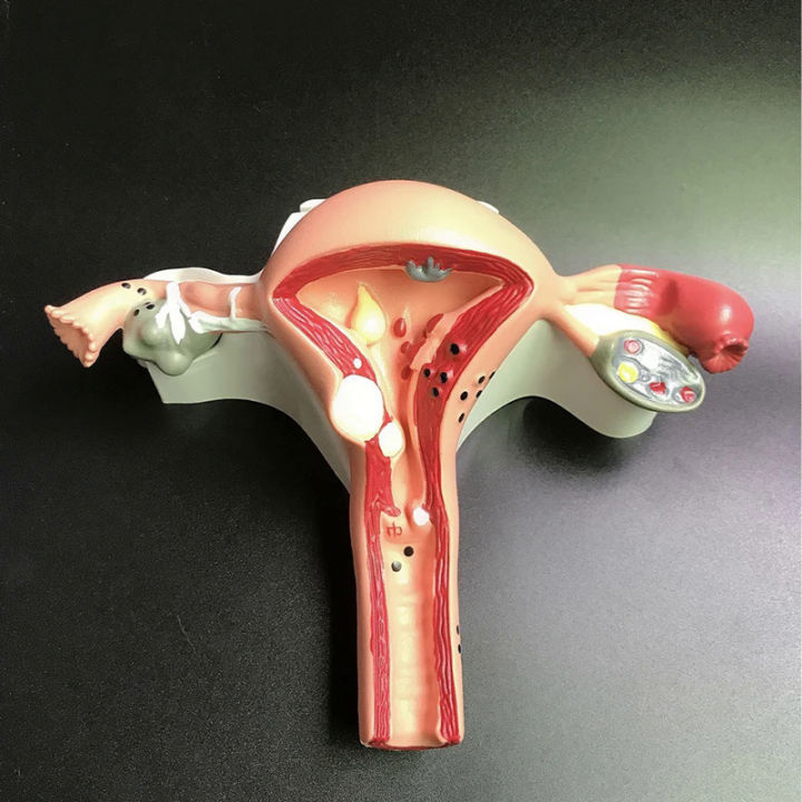 Human Uterus and Ovary Model, Female Reproductive Organ Model, Life ...