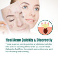 Eelhoe Colorful Acne Patch Star Pimple Patch Acne Coloful Invisible Acne Removal Stickers Originality Concealer Face Spot Beauty Makeup Tool L Invisible Acne Removal Pimple Patch Beauty Acne Tools Pimple Acne Concealer Face Spot Scar Care Stick(122pcs). 