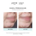 Juva by Zap Oil Balancing Acne Gel Moisturizer 40ml. 