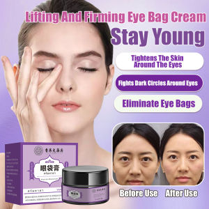 ✨Multi-effect Eye Cream To Repair Eye Wrinkles And Eye Bags / Eye Care Reduced Puffiness Eye Essence Improve Dark Circles Firms the Skin Around the Eyes Anti-aging