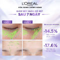 Tinh Chất Hyaluronic Acid Cấp Ẩm Sáng Da L'Oreal Revitalift 1.5% Hyaluronic Acid Serum Hasaki Sản Phẩm Chính Hãng. 