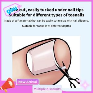 gou 50 cái dụng cụ chỉnh móng chân mọc ngược miếng dán đàn hồi điều trị móng chân mọc ngược miếng dán kẹp thẳng dụng cụ móng chân