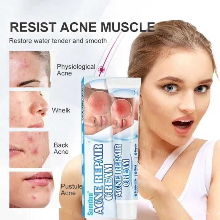 View of Acne remover cream acne marks pimple marks remover cream acne removal ...