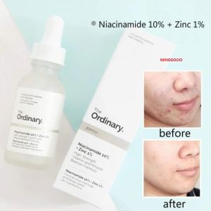 Genuine The Ordinary Niacinamide 10%+Zinc 1% 30ml Canada Original Product