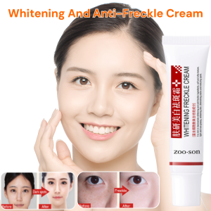 Whitening And Anti-Freckle Cream Removes Age Spots Melasma Freckles Sun Spots