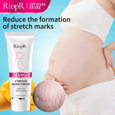 RtopR Mango Stretch Marks Cream Remove Pregnancy Scar Treatment Maternity Repair Firming Cream 40g