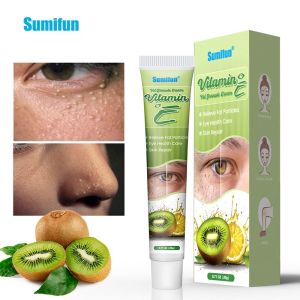 Fat Granules Remover Eye Cream Effective Remove Fat Granules Puffiness Anti-Particles Remover Product Repair Eye Skin Care