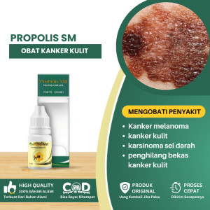 Obat Kanker Kulit Obat Kanker MelanomaObat Herbal Kanker Kulit AlamiKarsinoma Sel Basah - Propolis SM