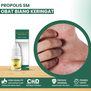 Obat Biang Keringat Obat Miliaria Rubra Obat Bintik Bintik Merah Di Badan Obat Gatal Biang Keringat Obat Menghilangkan Bintik Merah Obat Ruam Di Kulit Dengan Propolis SM