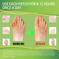 Gout treatment relief patch for rayuma, foot, hand and joint knee pain, uric acid medicine and arthritis herbal plaster. 