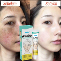 Sumifun Cream Penghilang Flek Hitam Whitening Freckle Cream Krim Bintik Melasma Mencerahkan Kulit Efektif Menghilangkan Bintik Hitam 20g. 