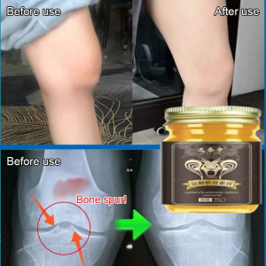 Applicator Amino Chondroitin Joint Balm for Joint Pain Treatment