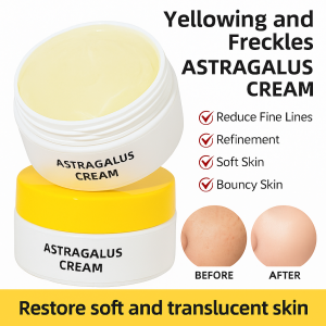 【Ready Stock】Freckle Removal Astragalus Cream Improves Dull Skin Remove Chloasma And Age Spots Enuine Moisturizing Face Cream