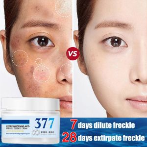 377 美白淡斑面霜  whitening freckles removal cream dark spot remover cream 50g Remove acne scars Brighten skin colour
