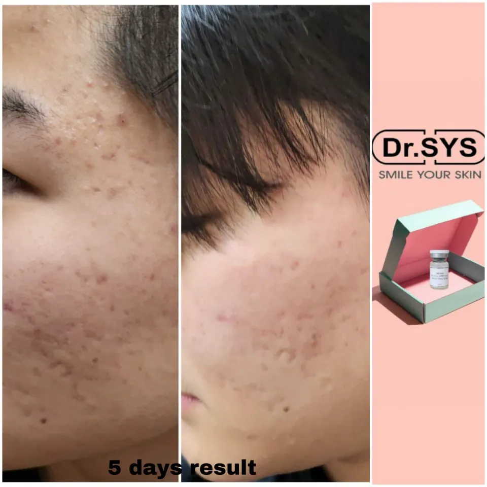 DR.SYS PS Stem Cell Ampoule - Lazada | Lazada