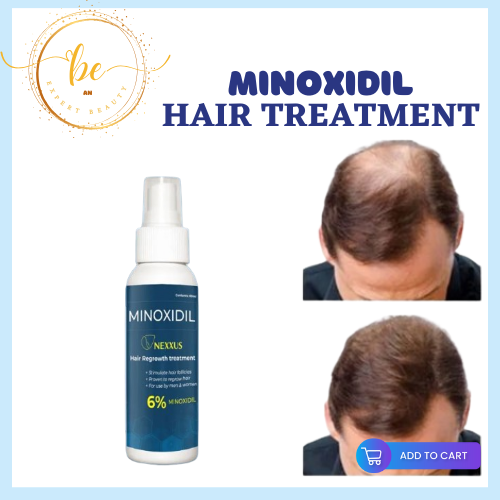 Minoxidil Hair Grower Beard And Hair Growth Spray Minoxidil spray ...