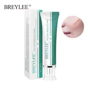 BREYLEE Acne Scar Removal Cream Fading Stretch Marks Scar Remover 30g