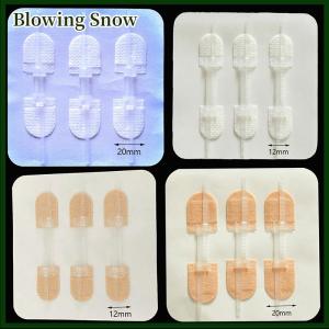 Blowing Zipper Tie Wound Closure Patch Hemostatic PatchWound Fast Suture Zipper Band-Aid