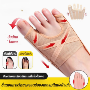 ชุดเสริมนิ้วหัวแม่มือ ภาวะวาลกัส/ชุดแก้ไขนิ้วเท้าตาข่าย รองรับนิ้วเท้าใหญ่ ชุดแก้ไขนิ้วเท้า รองเท้าแก้ไขนิ้วเท้าผิดรูป