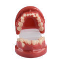 3D Resin Dental Model Teeth Malocclusion Model For Demostration Teaching Dental Students Study Oral Dentistry Products. 