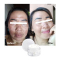 Penghilang Flek Hitam Paling Ampuh BPOM Salep Flek Hitam Ampuh Untuk Menghilangkan Flex Hitam Melasma Salep Flek Melasma Membandel Krim Penghilang Flek Hitam Di Wajah Permanen Cream Flek Khusus Flek Bandel Glowing Cream Leika Penghilang Flek Hitam Melasma. 