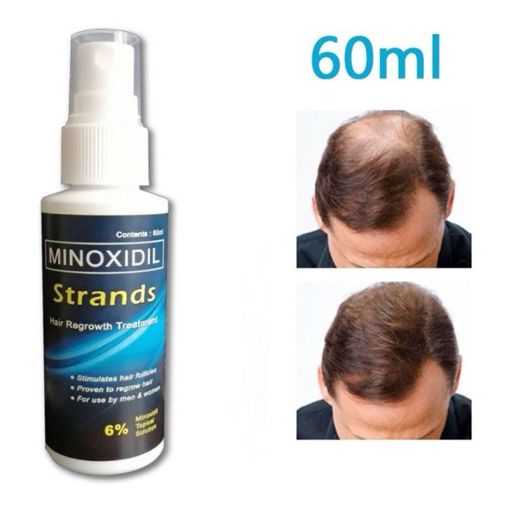 Original Minoxidil Strands 6% Minoxidil Premium Hair Grower Topical ...