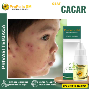 Obat Cacar Obat Penghilang Bekas Luka Cacar Obat Cacar Air Obat Cacar Api Obat Cacar Bernanah Obat oles Cacar Anak Dan Dewasa Salep Cacar - Propolis sm