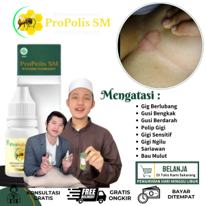 Obat Gatal Lipatan Payudara Obat Gatal Payudara Obat Ruam Merah Di Bawah Lipatan Payudara Obat Iritasi Payudata Obat Puting Lecet Dan Gatal Obat Penghilang Jamur Di Lipatan Payudara Dengan ProPolis SM
