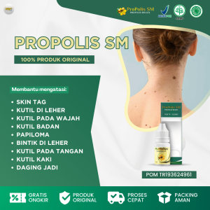 Propolis SM Obat Kutil Leher Penghilang Kutil Di Leher Obat Skin Tag Obat Kutil Di Wajah Kutil Di Tangan Kaki Kutil Badan Daging Jadi Kutil Papiloma Skin Tag Removal Atasi Dengan Propolis SM