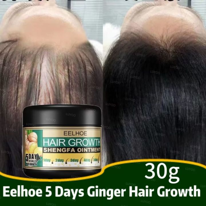 Eelhoe 5 Days Ginger Hair Growth Care Ointment Hair Fast Regrowth