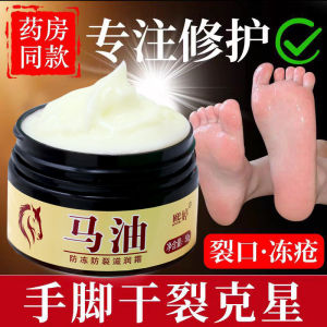Kem mỡ ngựa nứt gót chân nẻ da tay chân á sừng