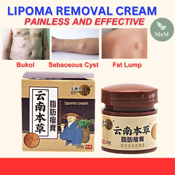 MsM Bukol Remover Ointment Effective Neck & Skin Lump Removal Medicine