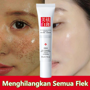 Whitening Freckle Cream Remove Dark Spot Cream Perawatan Kulit Pemutih Efektif Menghilangkan Melasma Jerawat Bintik Hitam Pigmentasi