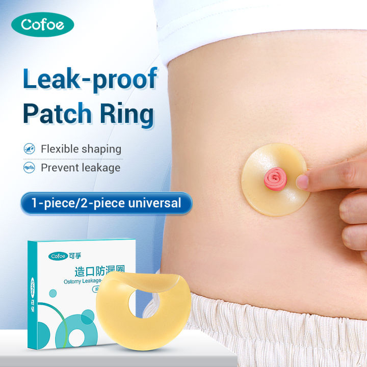 Cofoe Ostomy Bag Paste Ring Stoma Baseplates Leak proof Ring Moldable