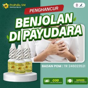 Obat Penghancur Benjolan Di Payudara Tumor Kista Kanker Infeksi Payudara Bahan Alami Propolis SM