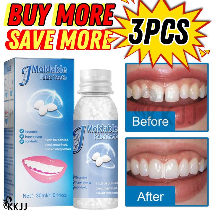 MOCHI [BUY 1 TAKE 1] Temporary Tooth Repair Kit Teeth and Gaps Moldable ...