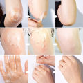 AZLA Vitamin C Peeling Lotion Remove Dead Skin Exfoliating Whitening and Smoothing New Skin Body Skincare Product 100ml. 