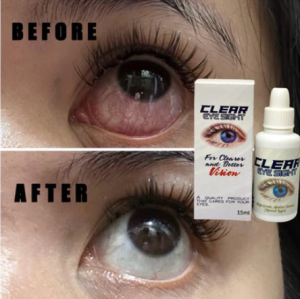Clear Vision Eye Refreshing Drops 15ml Gentle Daily Eye Care...