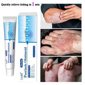 100% Effective Herbal Psoriasis Dermatitis Eczema Pruritu Psoriasis Cream Ointment Anti-Itch Cream Acne Keratosis Dermatitis Psoriasis Eczema Anti-Rash Lotion Topical MedicatedTraditional Herbs Antifungal Ointments for Dermatitis Allergy Skin 20g