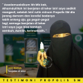 Obat Oles Pengempis Benjolan Di Kelopak Mata Bintitan dan Bintilan Kalazion Propolis SM Brazilian. 