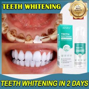 ALIVER Oral Care Teeth Whitening Mousse Pemutihan Gigi Mousse Pasta Gigi Kebersihan Mulut Menghapus Noda Plak Gigi Membersihkan Gigi Alat Putih 60ml
